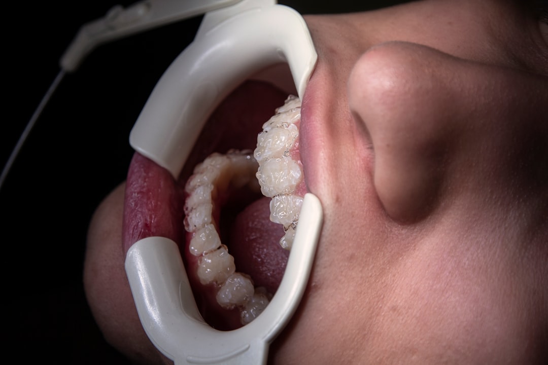 Betydningen af dental Behandling i Dagligdagen